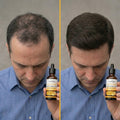 SÉRUM CAPILAR ANTICAÍDA
